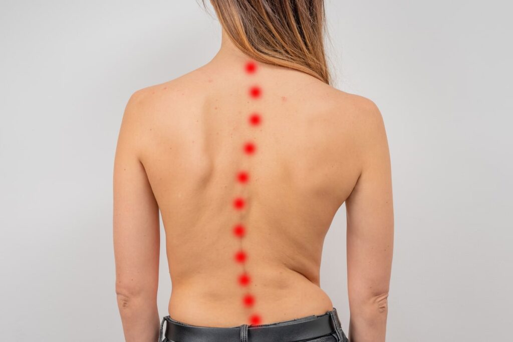 Woman’s bare back with red markers along the spine, indicating areas of spinal discomfort.