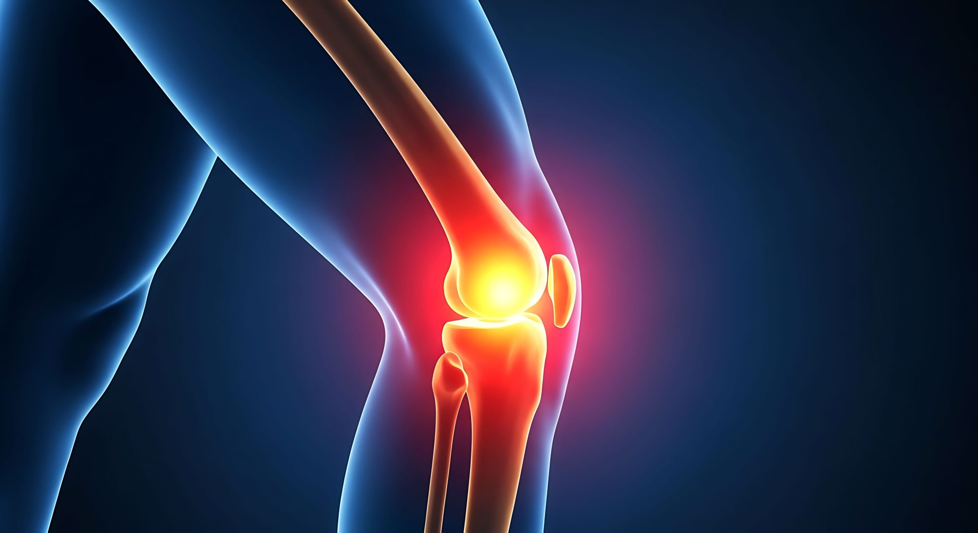 Medical illustration of the knee joint with red and yellow highlighting to represent knee pain and inflammation.